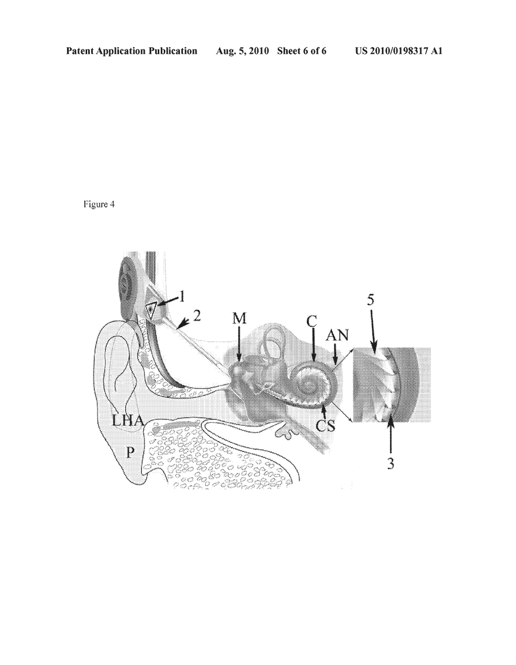 COCHLEA STIMULATOR - diagram, schematic, and image 07