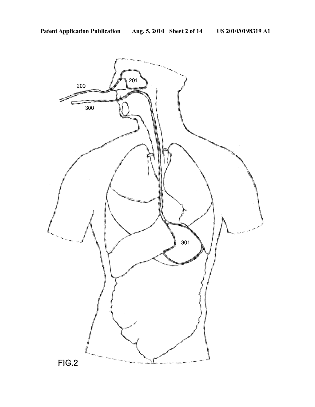 SYSTEM AND METHOD FOR MANIPULATING A TEMPERATURE OF A PATIENT - diagram, schematic, and image 03