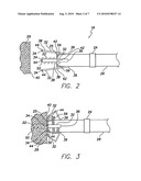 Active Fixation Implantable Medical Lead Configured to Indicate via Fluoroscopy Embedment of Helical Anchor in Cardiac Tissue diagram and image