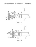 Active Fixation Implantable Medical Lead Configured to Indicate via Fluoroscopy Embedment of Helical Anchor in Cardiac Tissue diagram and image