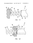 Active Fixation Implantable Medical Lead Configured to Indicate via Fluoroscopy Embedment of Helical Anchor in Cardiac Tissue diagram and image