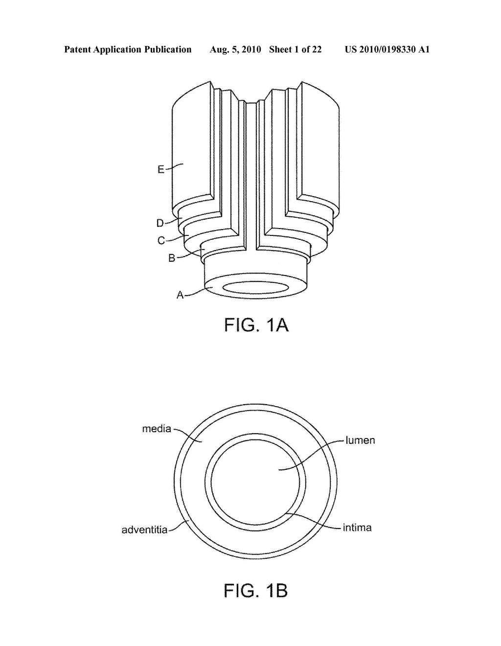 Bioabsorbable Stent And Treatment That Elicits Time-Varying Host-Material Response - diagram, schematic, and image 02