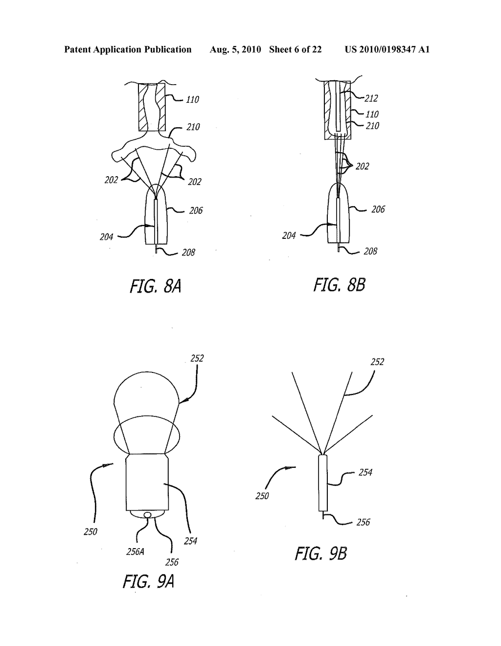 DEVICE AND METHOD FOR TREATMENT OF HEART VALVE REGURGITATION - diagram, schematic, and image 07