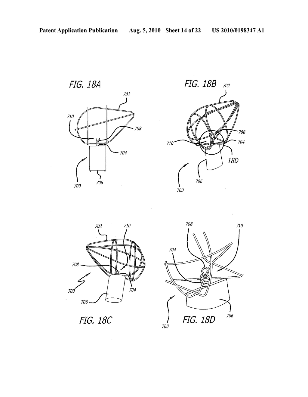 DEVICE AND METHOD FOR TREATMENT OF HEART VALVE REGURGITATION - diagram, schematic, and image 15