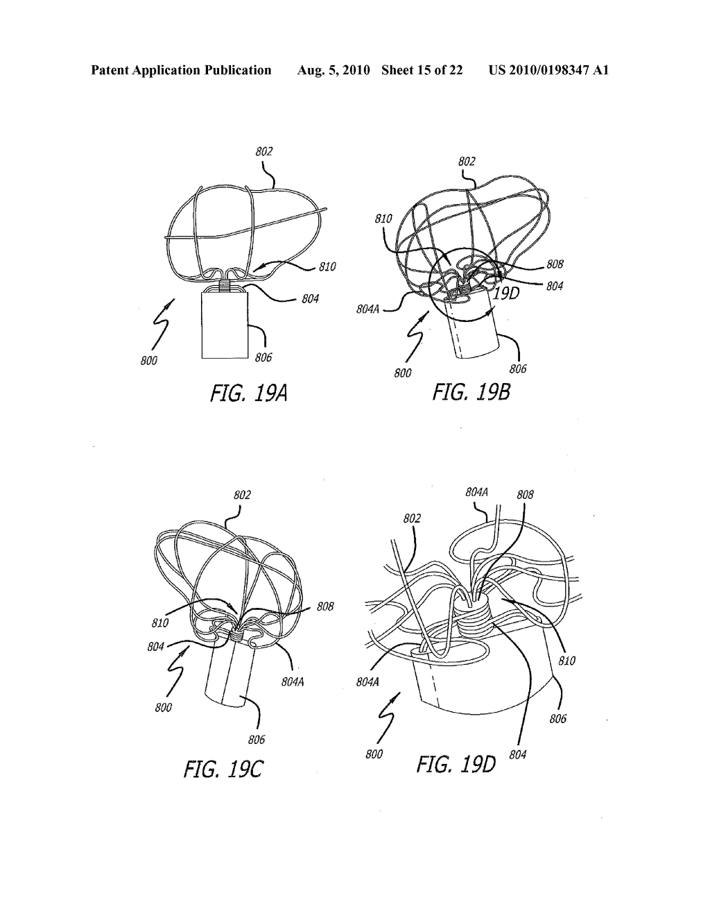 DEVICE AND METHOD FOR TREATMENT OF HEART VALVE REGURGITATION - diagram, schematic, and image 16
