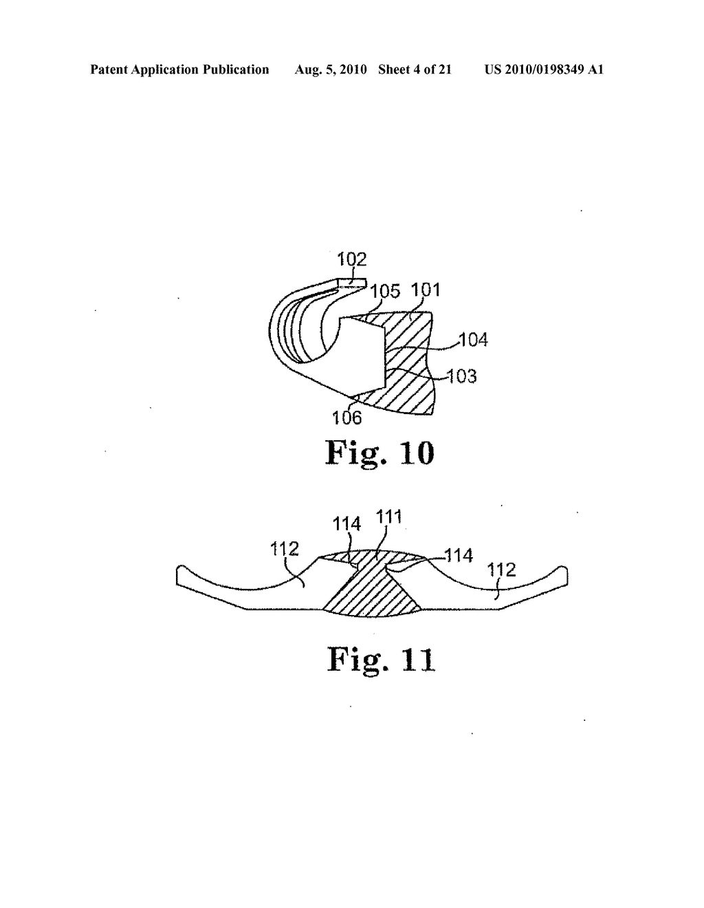 ACCOMMODATING INTRAOCULAR LENS - diagram, schematic, and image 05