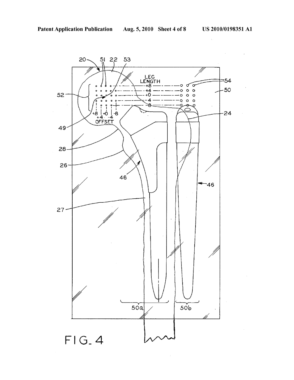 METHOD FOR SELECTING MODULAR IMPLANT COMPONENTS - diagram, schematic, and image 05