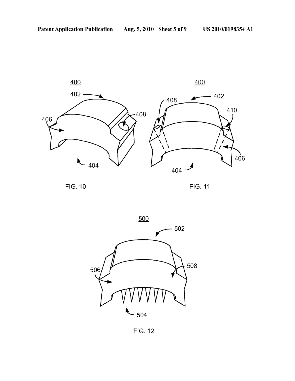 METHOD AND SYSTEM FOR PATELLA TENDON REALIGNMENT - diagram, schematic, and image 06