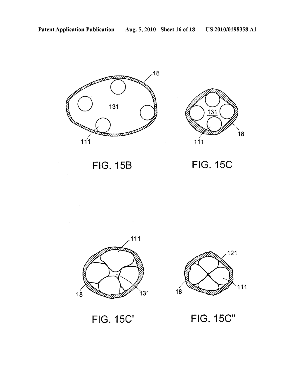 URETERAL STENT FOR IMPROVED PATIENT COMFORT - diagram, schematic, and image 17