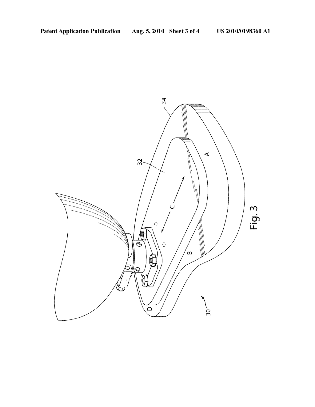 Foreshortened prosthetics for bilateral leg amputees - diagram, schematic, and image 04