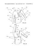 REVERSIBLE SLEEVED GARMENT ACCESSORY diagram and image