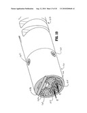 Flexible Endoluminal Surgical Instrument diagram and image