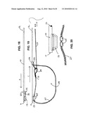 LASSO HANDLING DEVICE diagram and image