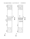 Pregnancy Belt diagram and image