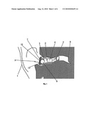 HEARING AID WITH ANTENNA FOR RECEPTION AND TRANSMISSION OF ELECTROMAGNETIC SIGNALS diagram and image