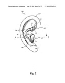 HEARING AID WITH AN ELONGATE MEMBER diagram and image