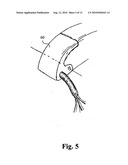 HEARING AID WITH AN ELONGATE MEMBER diagram and image