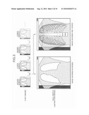 RADIATION DIAGNOSTIC APPARATUS, X-RAY COMPUTED TOMOGRAPHY APPARATUS, AND IMAGE PROCESSING METHOD diagram and image