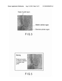 X-RAY DIAGNOSIS APPARATUS AND IMAGE PROCESSING METHOD diagram and image