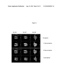 FIBRIN BINDING PEPETIDE CONJUGATES FOR DIAGNOSTIC AND THERAPEUTIC APPLICATIONS diagram and image