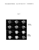 FIBRIN BINDING PEPETIDE CONJUGATES FOR DIAGNOSTIC AND THERAPEUTIC APPLICATIONS diagram and image