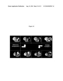 FIBRIN BINDING PEPETIDE CONJUGATES FOR DIAGNOSTIC AND THERAPEUTIC APPLICATIONS diagram and image