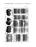 Therapeutics for Cancer Using 3-Bromopyruvate and Other Selective Inhibitors of ATP Production diagram and image