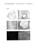 Therapeutics for Cancer Using 3-Bromopyruvate and Other Selective Inhibitors of ATP Production diagram and image