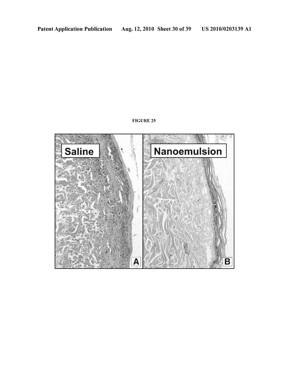 NANOEMULSION THERAPEUTIC COMPOSITIONS AND METHODS OF USING THE SAME - diagram, schematic, and image 31
