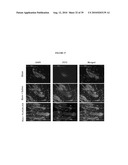 NANOEMULSION THERAPEUTIC COMPOSITIONS AND METHODS OF USING THE SAME diagram and image