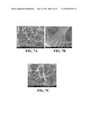 Immobilized Metallic Nanoparticles as Unique Materials for Therapeutic and Biosensor Applications diagram and image