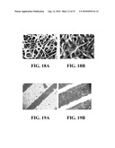 Immobilized Metallic Nanoparticles as Unique Materials for Therapeutic and Biosensor Applications diagram and image