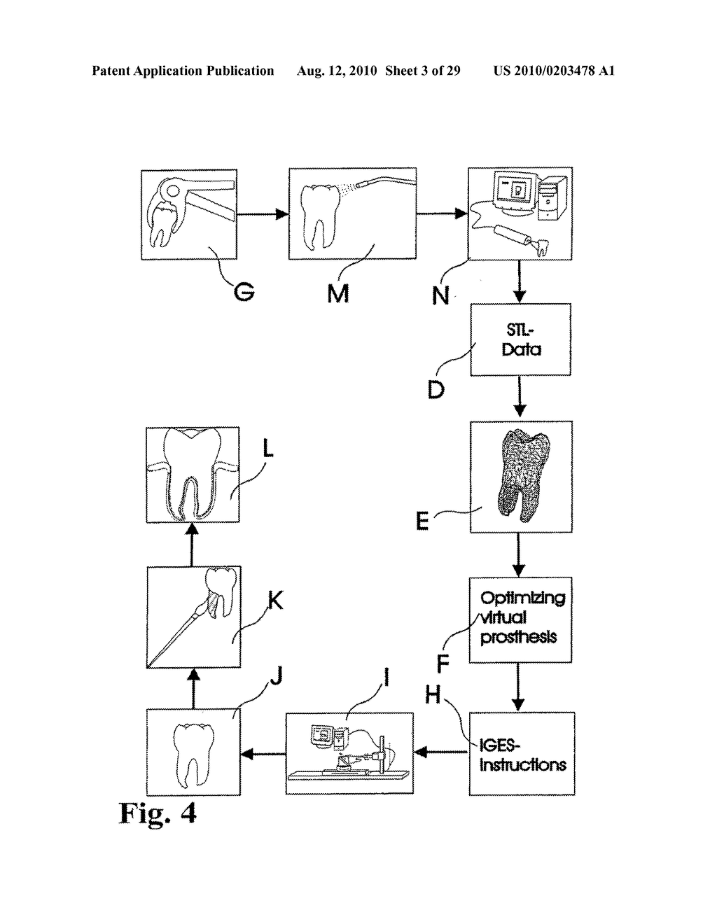 Customized Dental Prosthesis for Periodontal or Osseointegration and Related Systems and Methods - diagram, schematic, and image 04