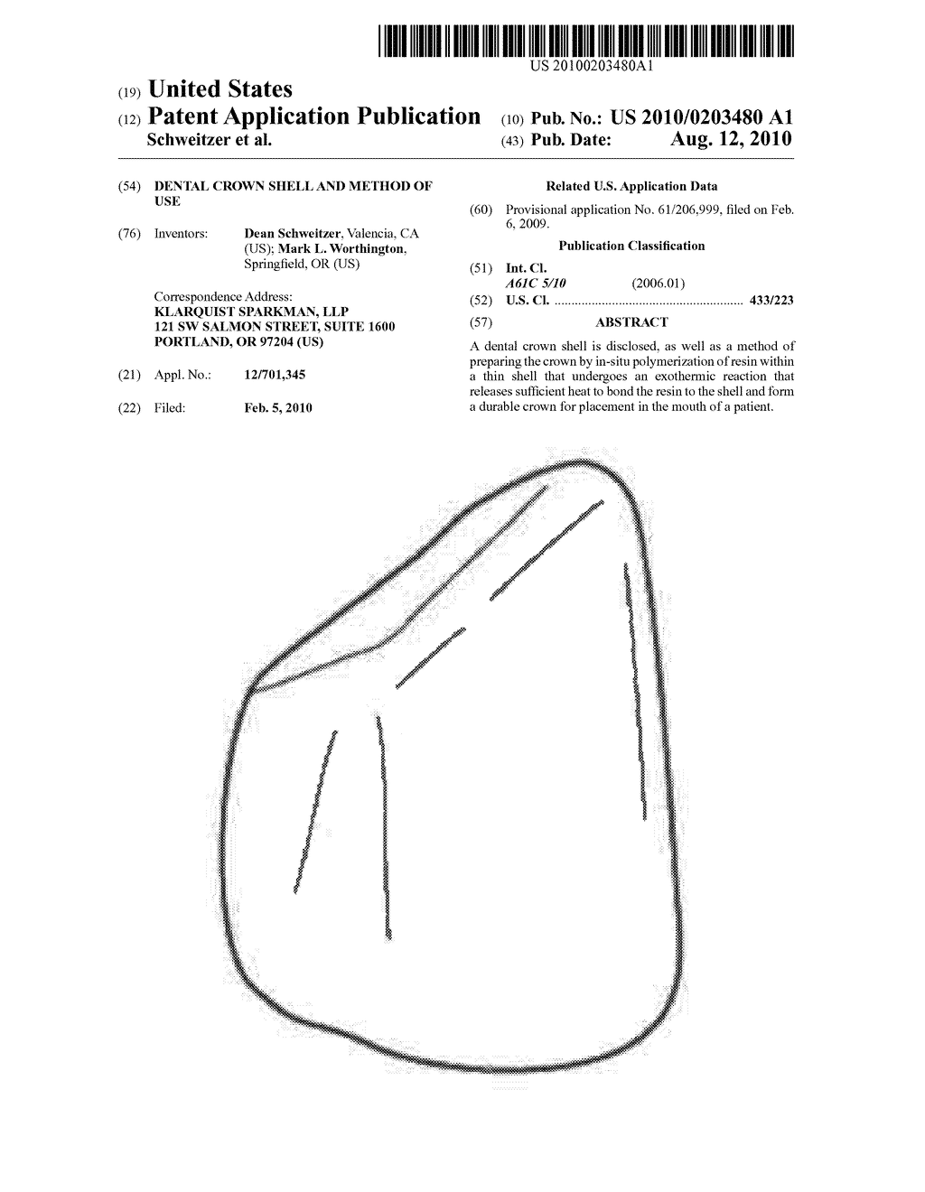 DENTAL CROWN SHELL AND METHOD OF USE - diagram, schematic, and image 01