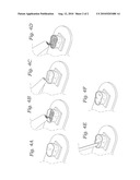 DENTAL CROWN SHELL AND METHOD OF USE diagram and image