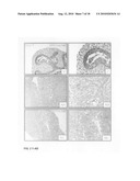 Inhibition of stem cell differentiation, enhancement of proliferation and selective induction of apoptosis by Wnt factors diagram and image