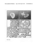 Inhibition of stem cell differentiation, enhancement of proliferation and selective induction of apoptosis by Wnt factors diagram and image