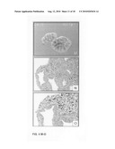 Inhibition of stem cell differentiation, enhancement of proliferation and selective induction of apoptosis by Wnt factors diagram and image