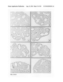 Inhibition of stem cell differentiation, enhancement of proliferation and selective induction of apoptosis by Wnt factors diagram and image