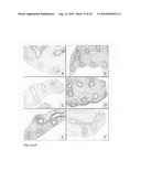 Inhibition of stem cell differentiation, enhancement of proliferation and selective induction of apoptosis by Wnt factors diagram and image