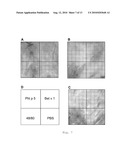 Antigen Presenting Cells diagram and image