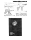 TREATMENT FOR LEUKEMIA AND IDIOPATHIC APLASTIC ANEMIA diagram and image