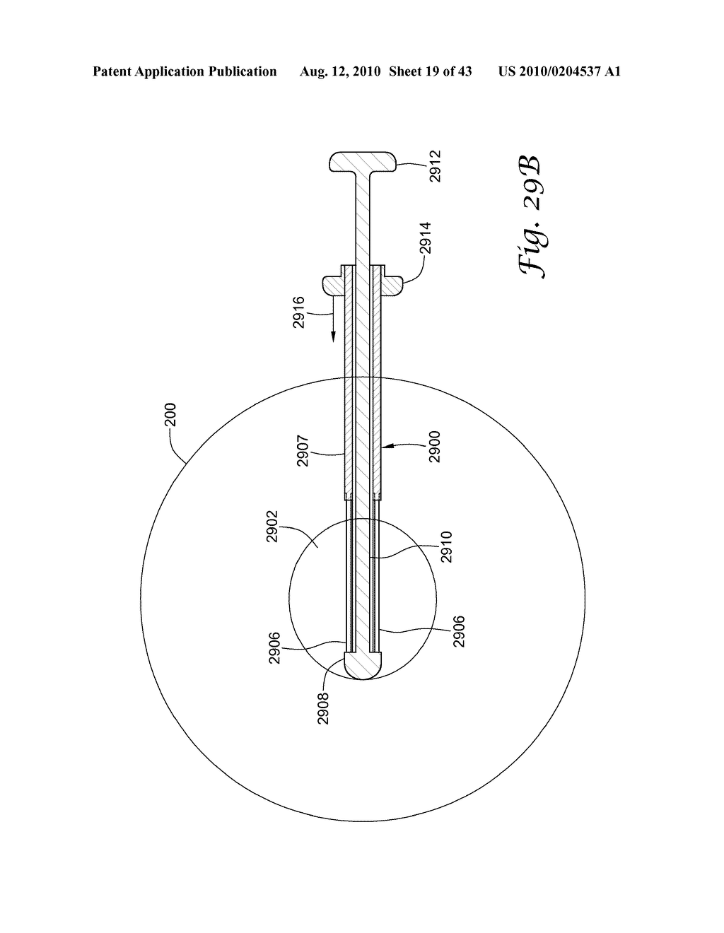 BRACHYTHERAPY APPARATUS AND METHODS FOR USING THEM - diagram, schematic, and image 20