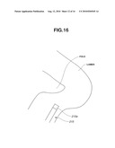 ENDOSCOPE SYSTEM diagram and image