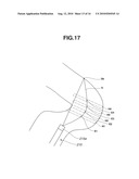 ENDOSCOPE SYSTEM diagram and image