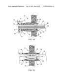 EXPANDABLE PORT FOR ACCESSING A BODILY OPENING diagram and image