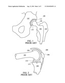 Detection, Prevention and Treatment of Infections in Implantable Devices diagram and image