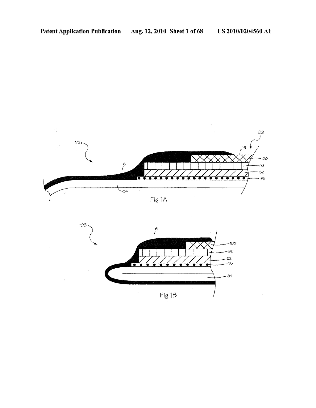 LOW PROFILE ELECTRODE ASSEMBLY - diagram, schematic, and image 02