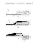 LOW PROFILE ELECTRODE ASSEMBLY diagram and image