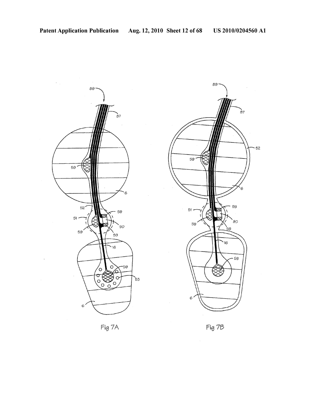 LOW PROFILE ELECTRODE ASSEMBLY - diagram, schematic, and image 13